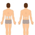 Understanding TENS: A Comprehensive Guide to Pain Management