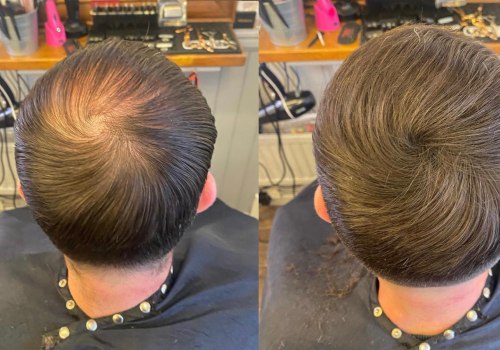 Understanding Hair Fibers